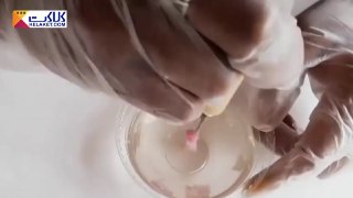 ژله تزریقی ۷